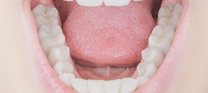Composite Fillings Discover Dental