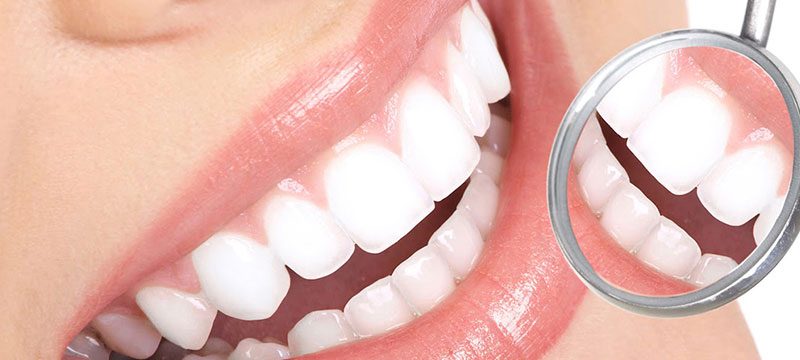 Zoom Whitening Discover Dental