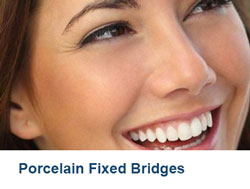 11-Porcelain-Fixed-Bridges