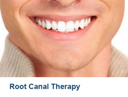 16-Root-Canal-Therapy